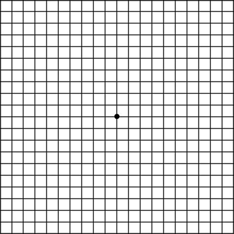 amsler recording chart|macular degeneration how long till blind.